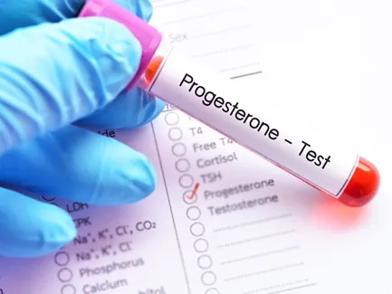 Get Your 17-OH Progesterone Levels Tested